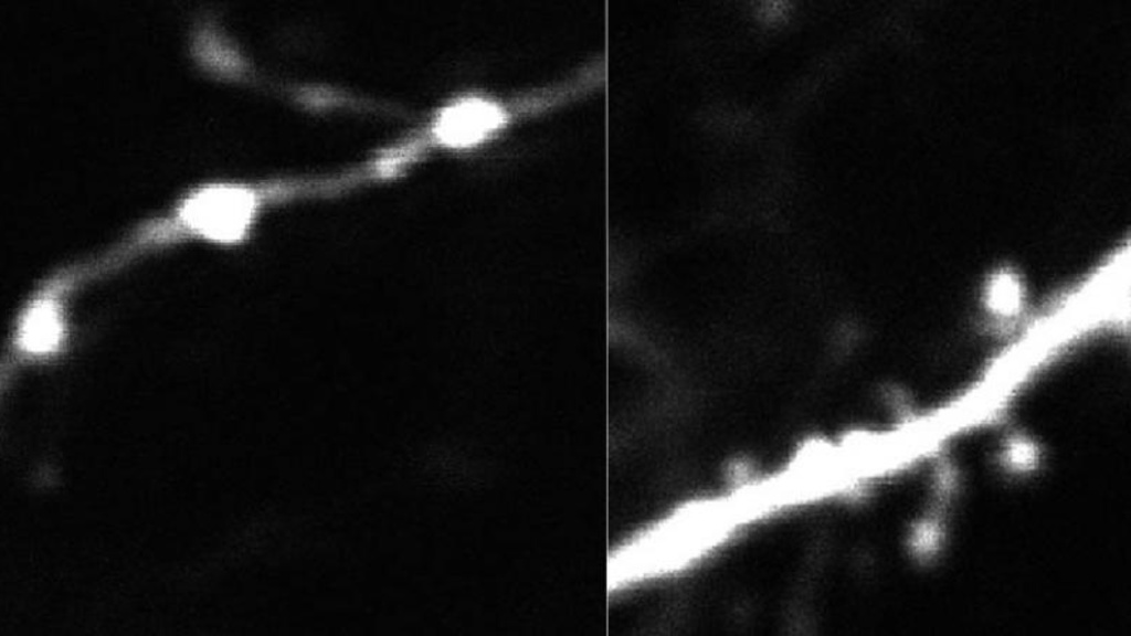Dendritic Spines