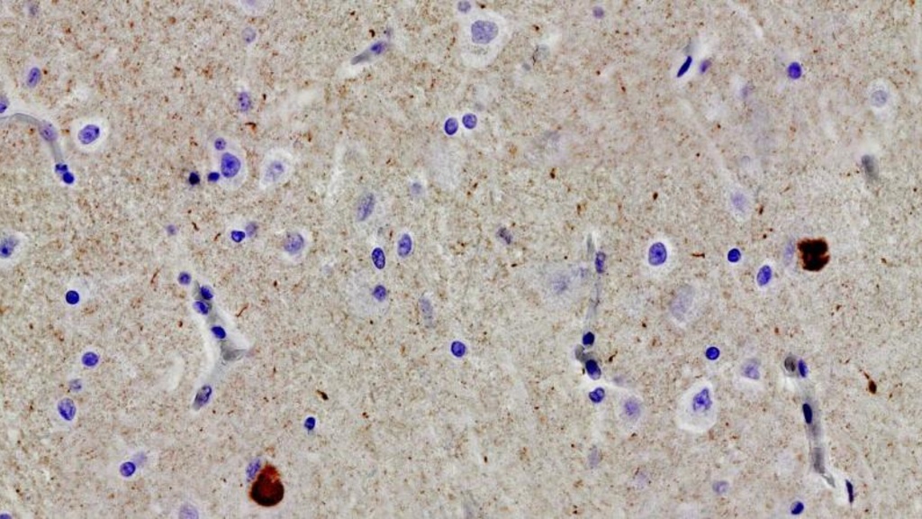 Alpha-synuclein Staining