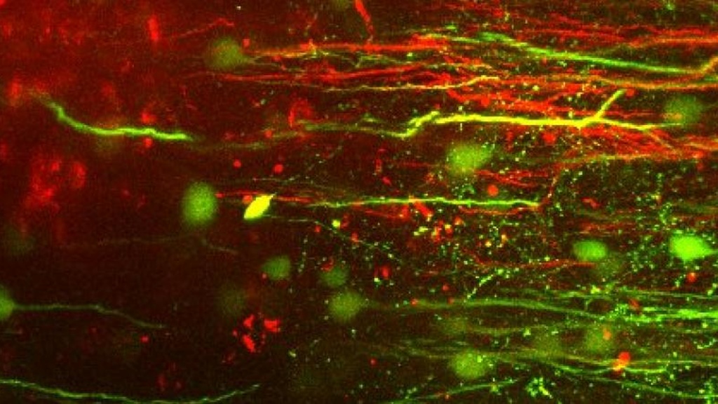  Prefrontal Apicals