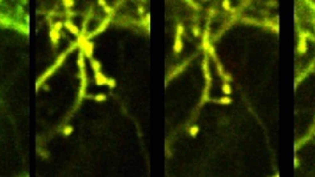 spines