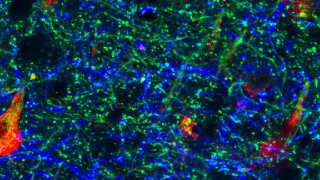 Alpha-synuclein immunostaining