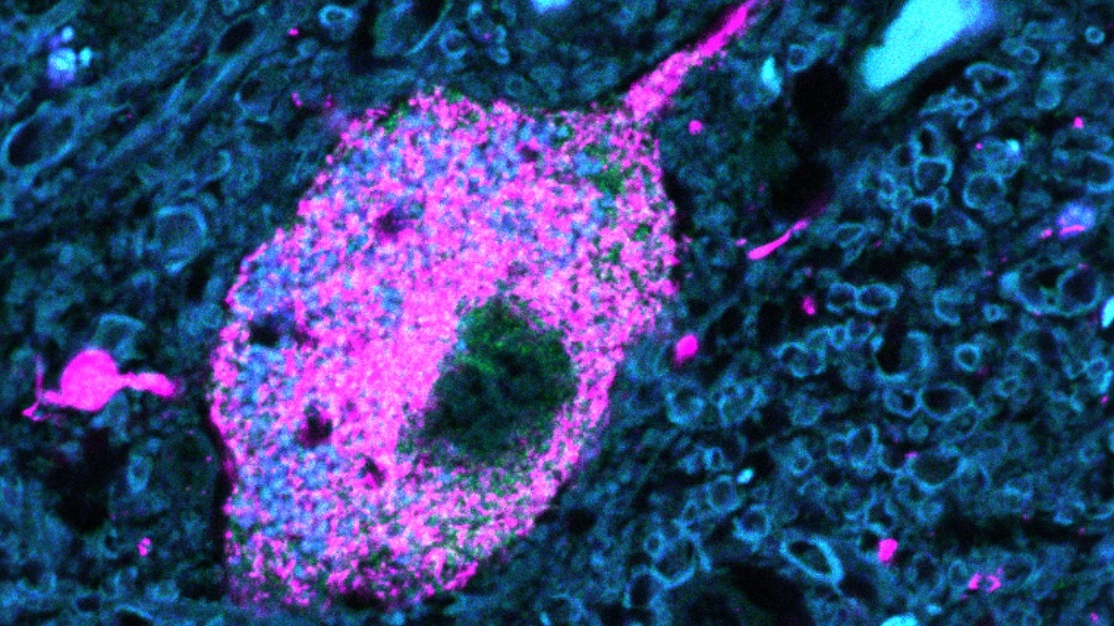 phospho-synuclein in human